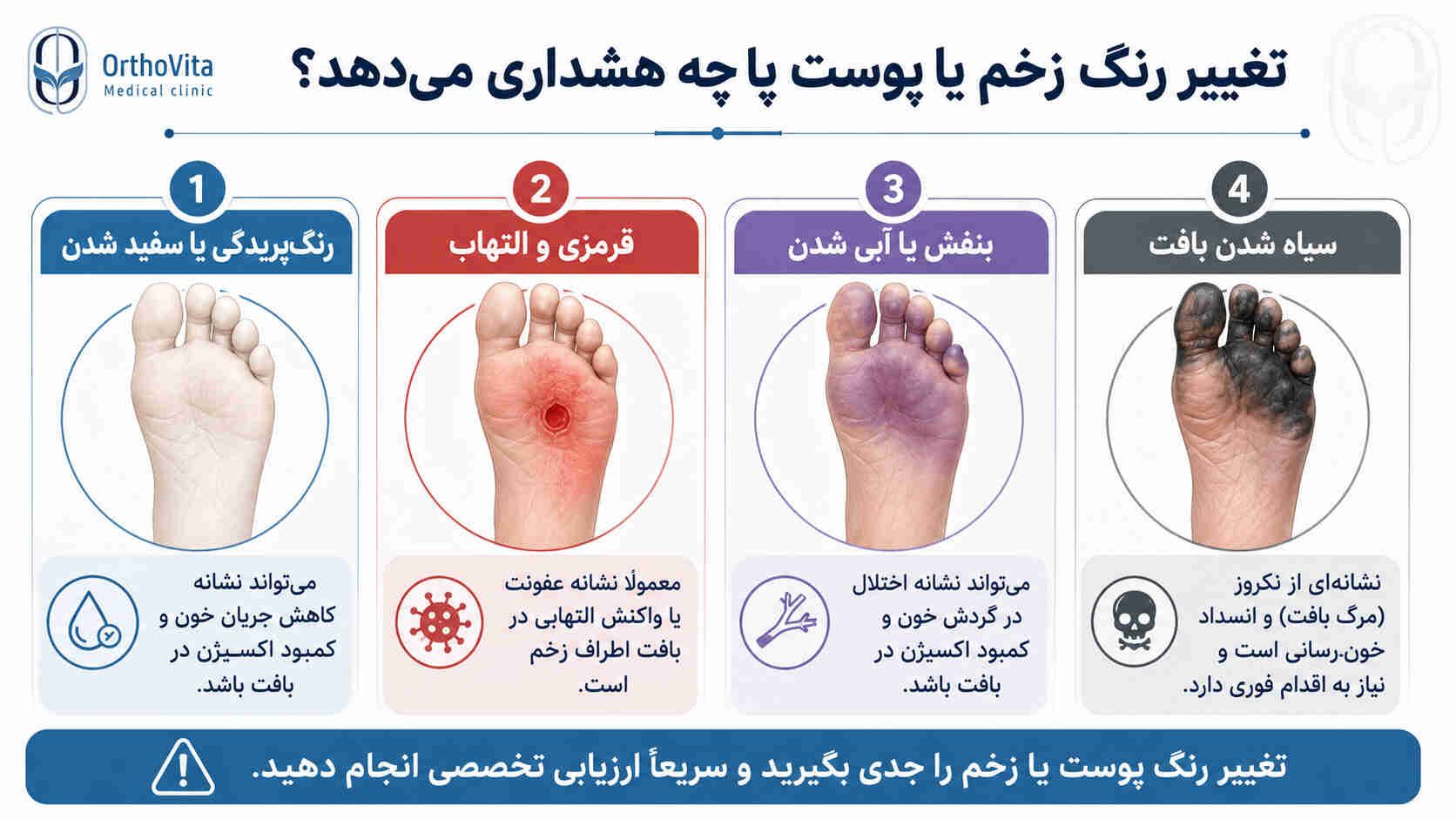 تغییر رنگ هشداردهنده در زخم پای دیابتی اینفوگرافی تغییر رنگ پوست پا شامل رنگپریدگی، قرمزی، بنفششدن و سیاهشدن بافت