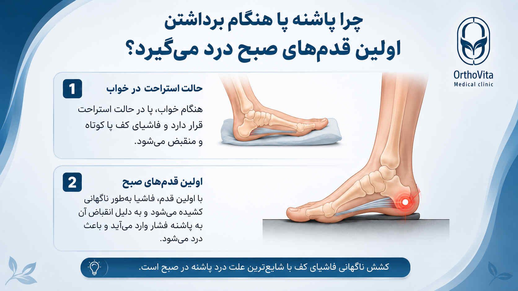 morning heel pain first step