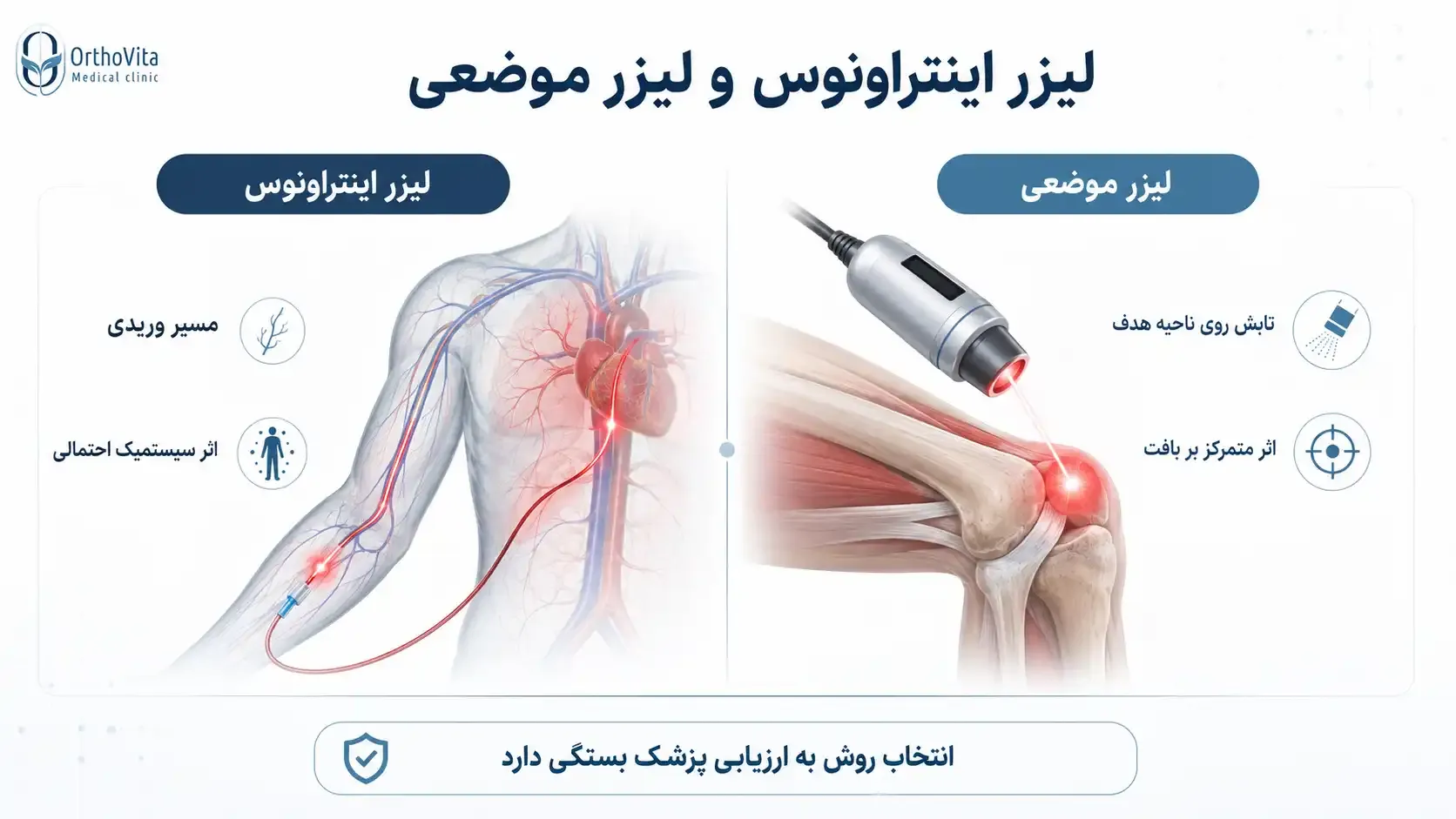 تفاوت لیزر اینتراونوس و لیزر موضعی مقایسه لیزر اینتراونوس با لیزر موضعی و تفاوت مسیر اثر آنها