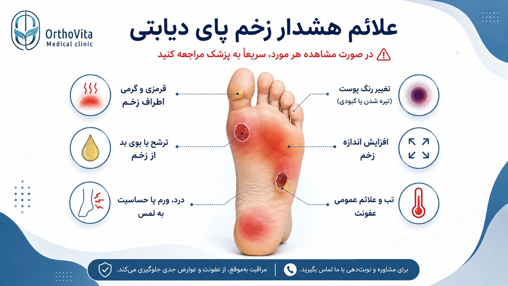 نشانههای خطر زخم پای دیابتی علائم هشدار زخم پای دیابتی و تغییرات نیازمند بررسی پزشکی