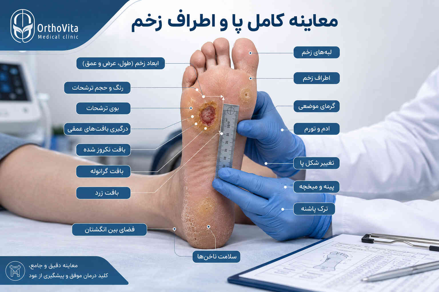 زخم پای دیابتی چیست؛ آشنایی ومعرفی