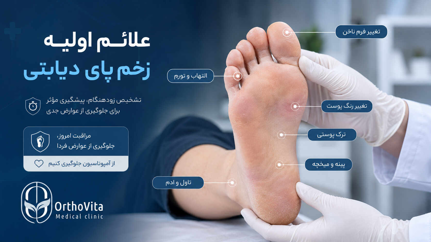 زخم پای دیابتی چیست؛ آشنایی ومعرفی