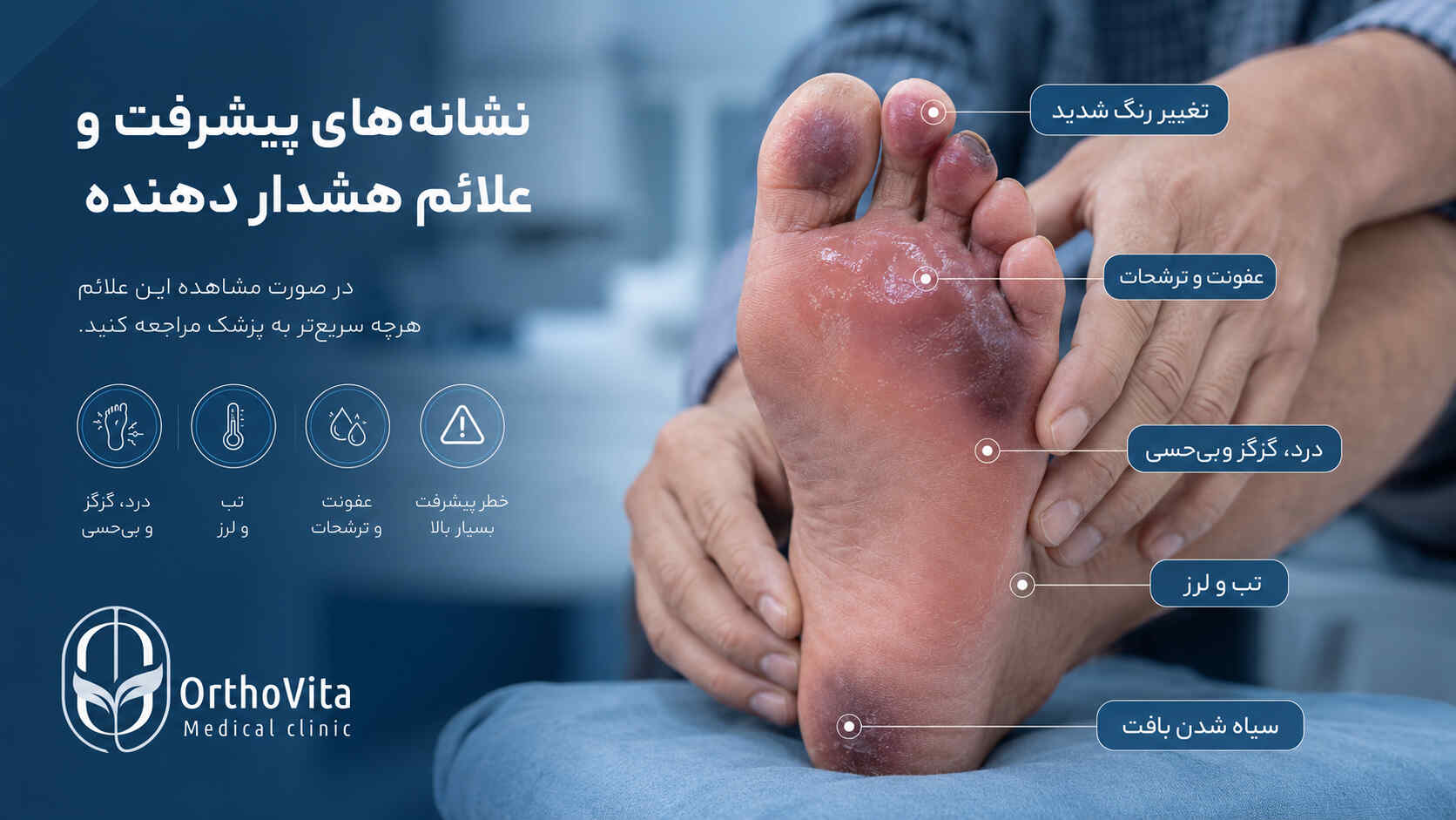 زخم پای دیابتی چیست؛ آشنایی ومعرفی