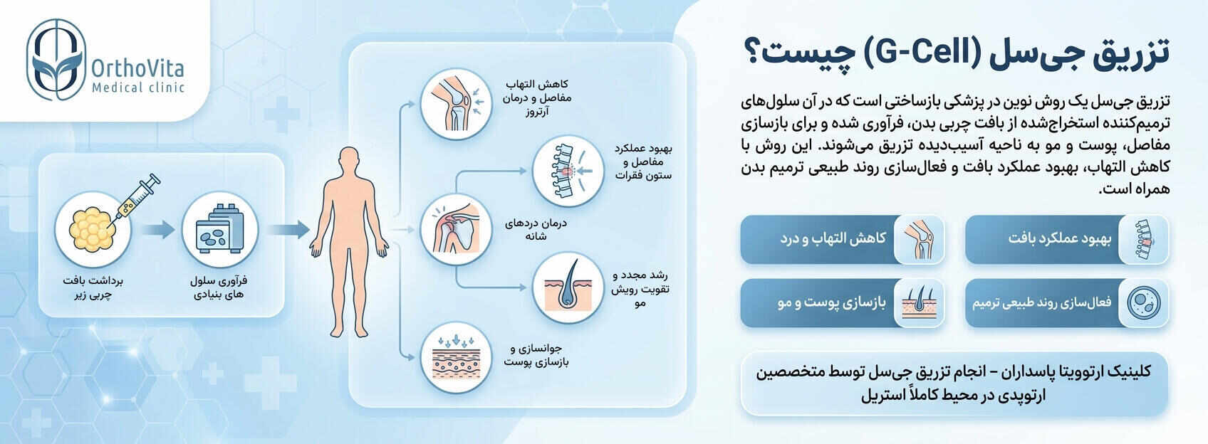 تزریق جی‌سل چیست و برای چه افرادی مناسب است؟
