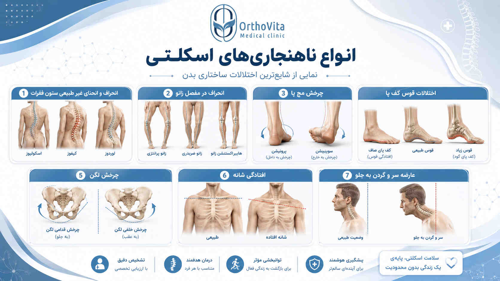 انواع ناهنجاری‌های بدن 